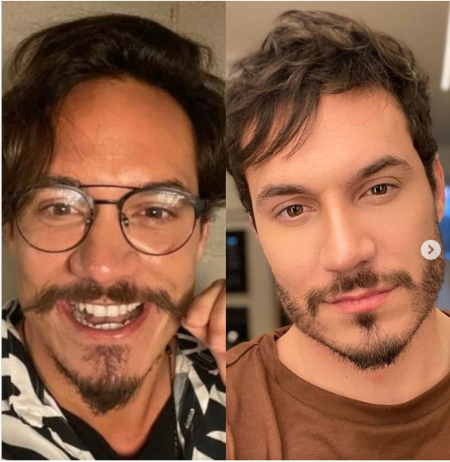 Por que as cirurgias plásticas são tão comuns em ex-BBB's?