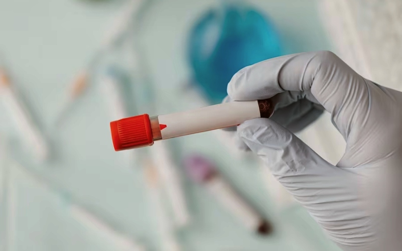 Alzheimer: primeiro exame de sangue que detecta a doença chega ao Brasil - Foto: Reprodução Freepik