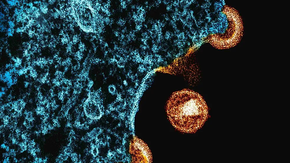 Microscopia eletrônica mostra partículas víricas do HIV brotando de célula infectada. Foto: Divulgação