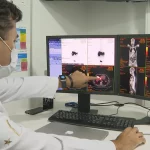 Rastreamento de câncer de intestino identifica lesões Foto: Reprodução/ TV Brasil