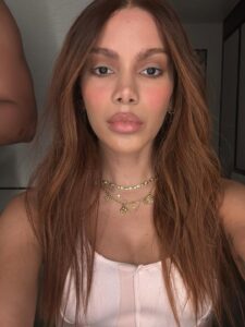 Brasil lidera em cirurgias plásticas, enquanto mundo apresenta queda Anitta surpreendeu nos últimos dias ao mostrar transformação. Foto: Instagram/@anitta