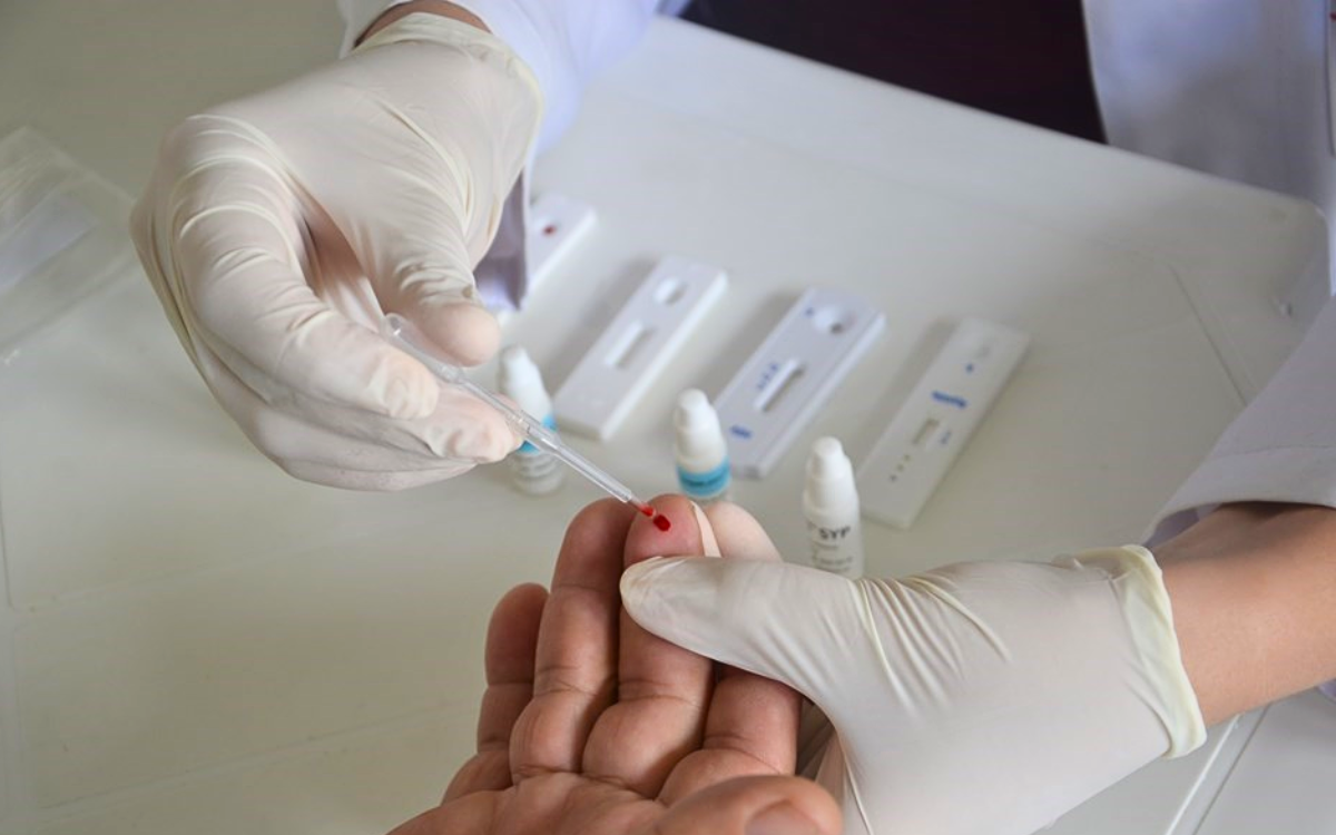 No Julho Amarelo, municípios ampliam oferta de testes rápidos. Foto: Governo do ES