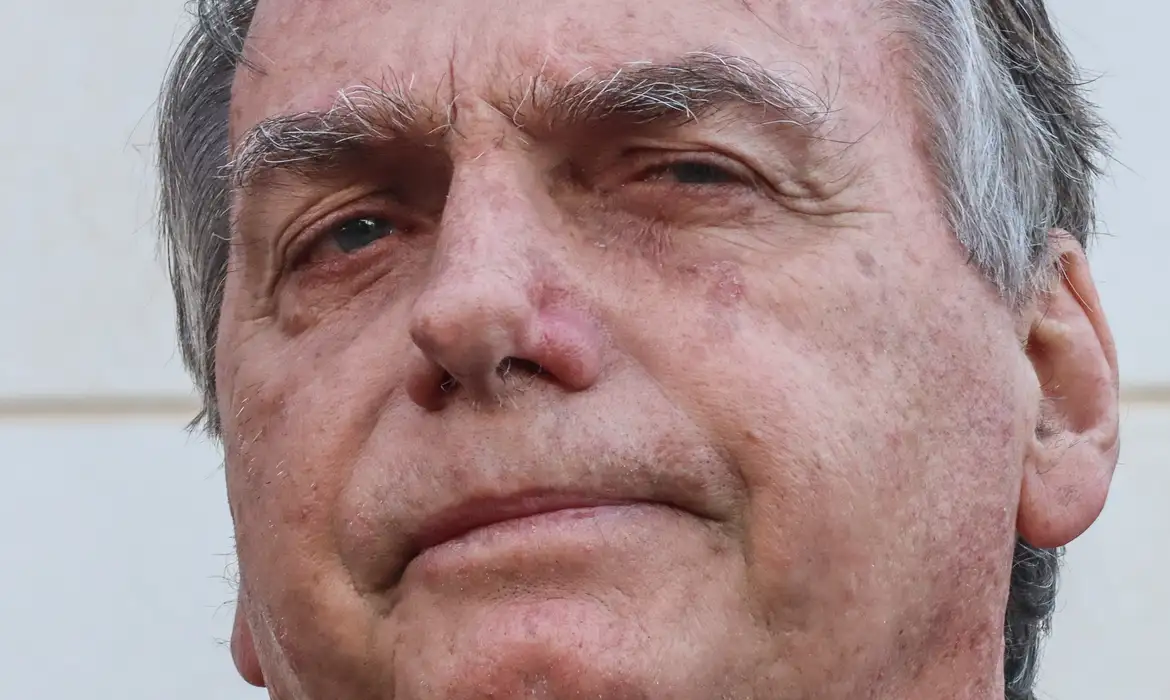 Ex-presidente Jair Bolsonaro passou por uma endoscopia, revelando inflamação no esôfago, além de outras complicações. Foto: Valter Campanato/Agência Brasil