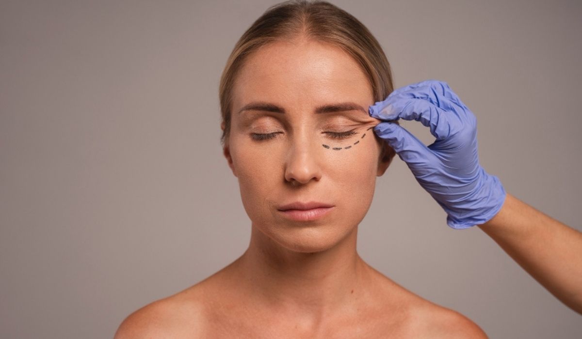 a blefaroplastia visa remover o excesso de pele e gordura das pálpebras, promovendo o rejuvenescimento periocular. Foto: divulgação/ Criar Comunicação