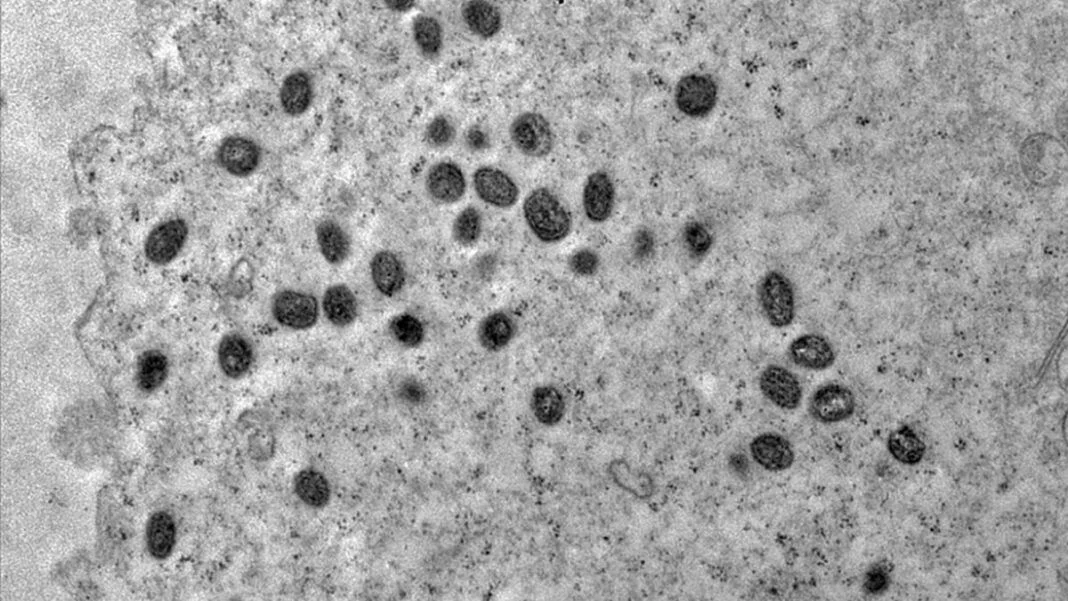 Casos de Mpox no Brasil em 2026, com foco em São Paulo e prevenção da doença. Foto: Debora F. Barreto-Vieira/IOC/Fiocruz